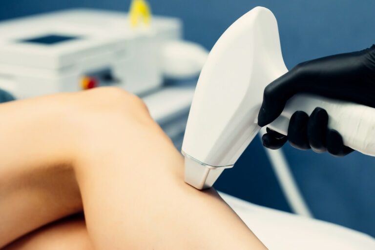 Bezpieczeństwo zabiegów laserowych w dermatologii